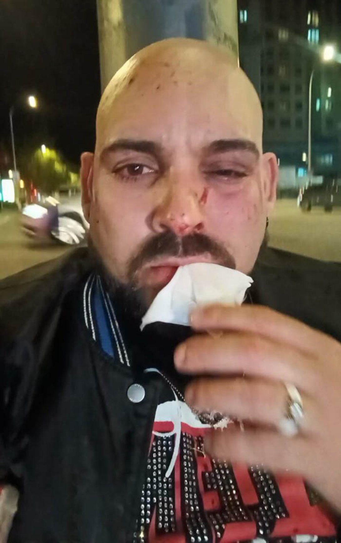 Lázaro Mireles tras ser brutalmente golpeado en Madrid.