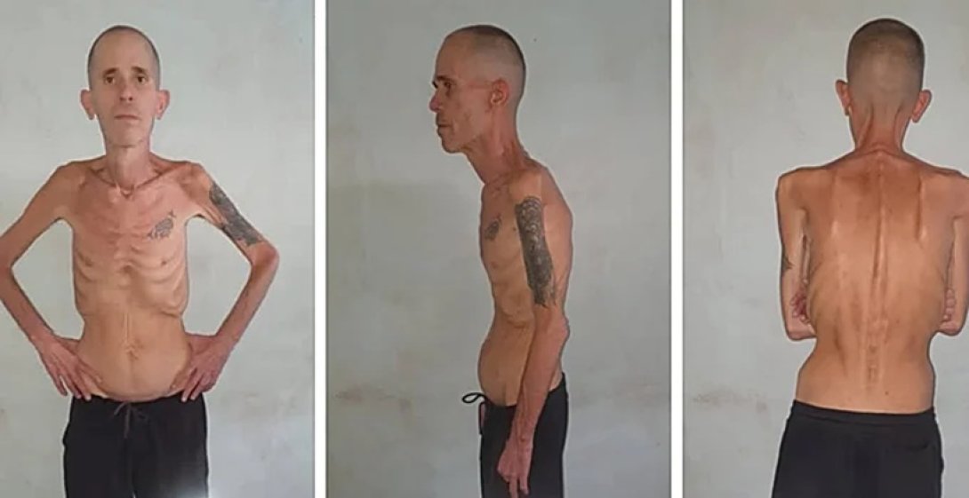 El expreso político cubano Alexander Díaz Rodríguez tras cumplir la pena de cinco años por participar en las protestas del 11 de julio de 2021 (11J).