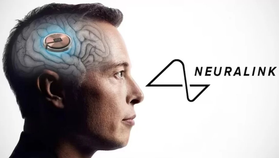 Anuncio de los implantes de Neuralink.