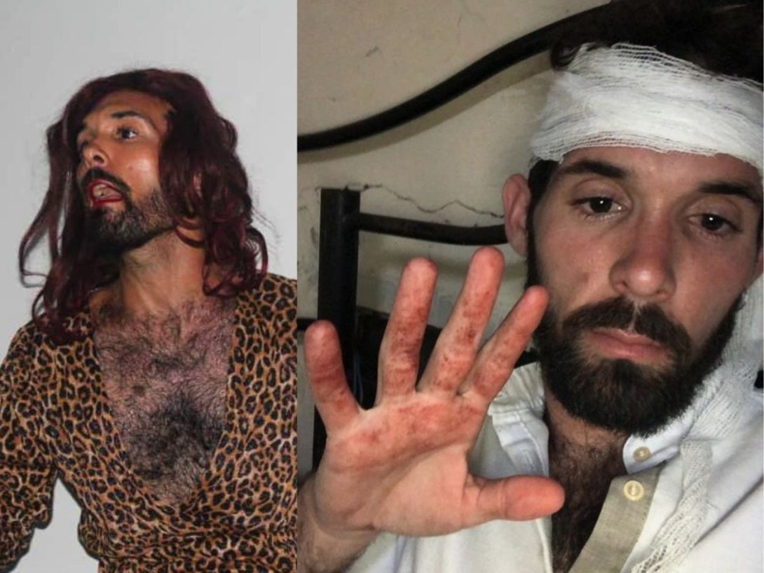 El artista cubano Yadian Rizo Abreu: interpretando su personaje La Verraca (izq.) y luego de recibir una golpiza por represores institucionales en abril de 2026. Tomado de Instagram.