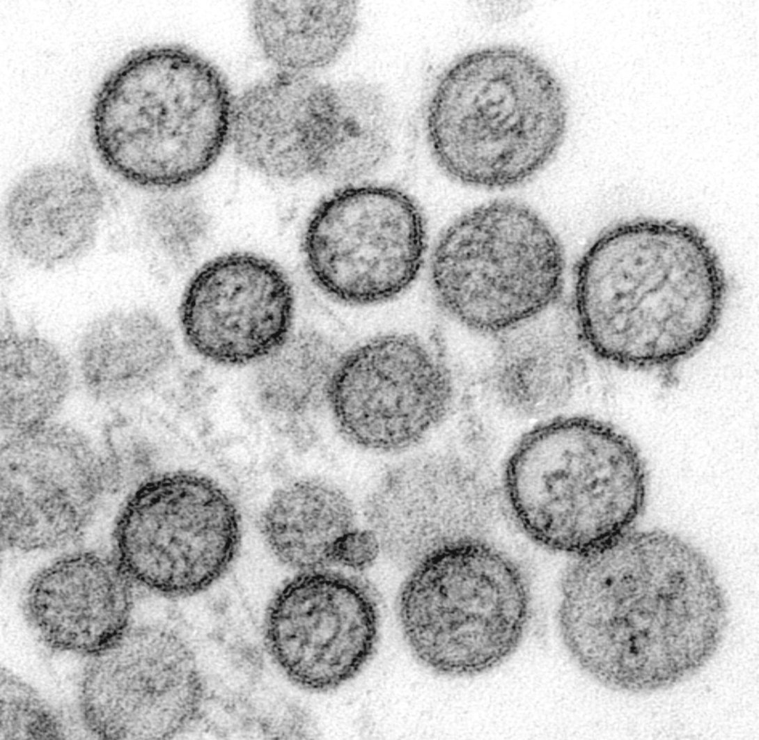Imagen de microscopio electrónico de un tipo de Hantavirus