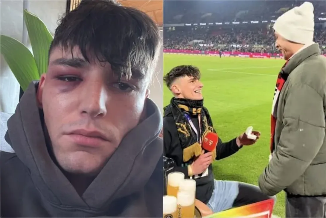 El árbitro alemán de fútbol Pascal Kaiser, quien fue agredido tras pedir matrimonio a su novio públicamente en estadio de Colonia, Alemania (enero-febrero de 2026).