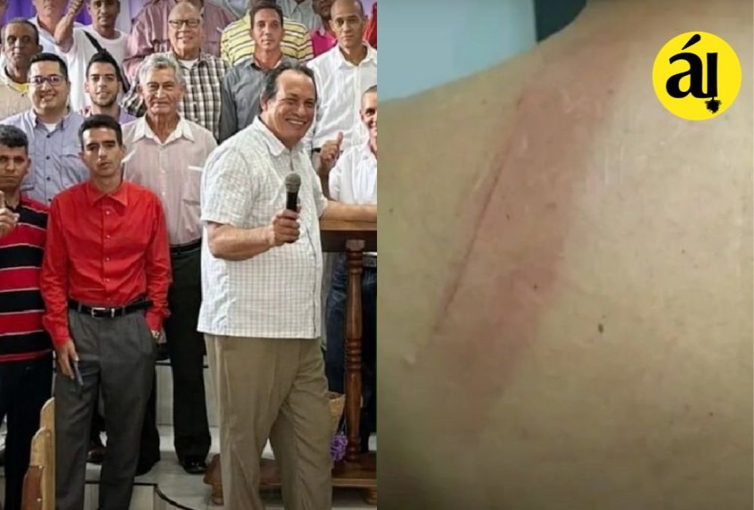 El obispo agredido en Santiago de Cuba.