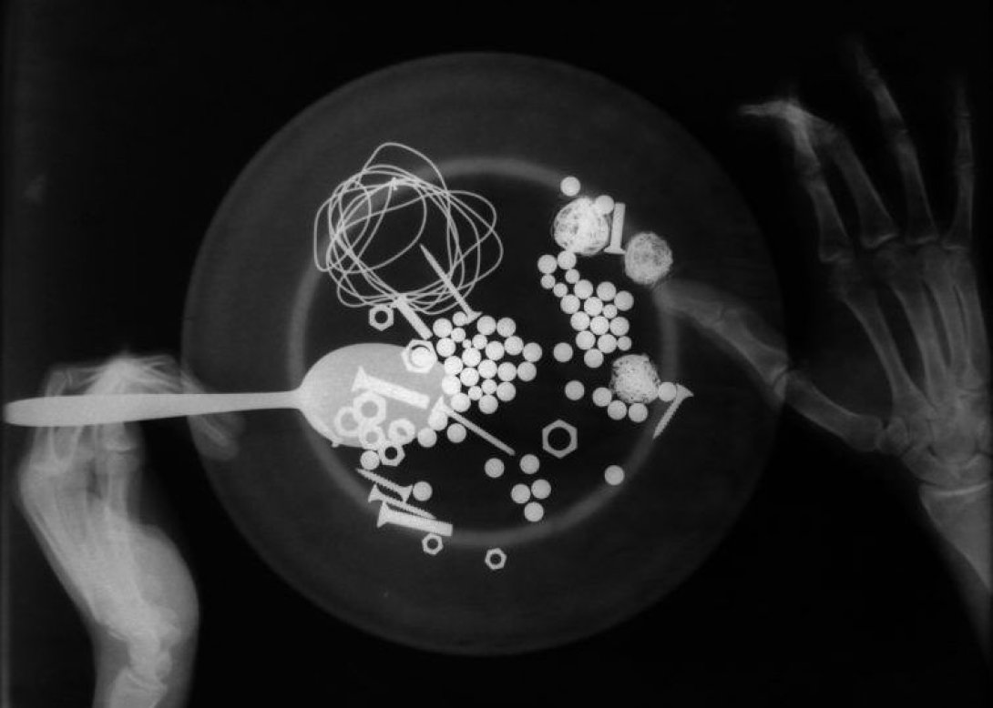 "Salud de hierro", foto de Yomer Montejo Harrys.