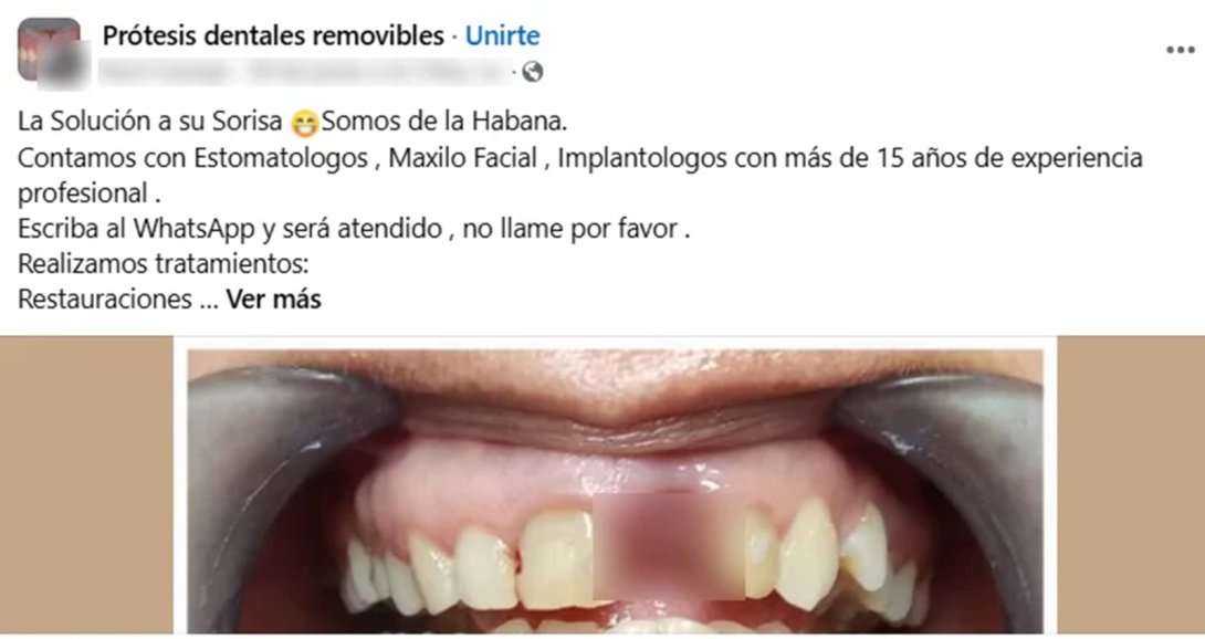 Anuncio de consulta privada de estomatología en Cuba. Captura de Facebook (2025).