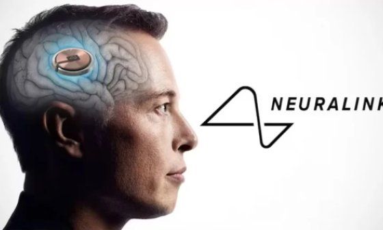 Anuncio de los implantes de Neuralink.