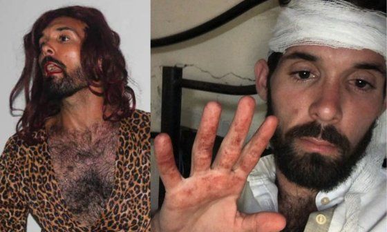 El artista cubano Yadian Rizo Abreu: interpretando su personaje La Verraca (izq.) y luego de recibir una golpiza por represores institucionales en abril de 2026.