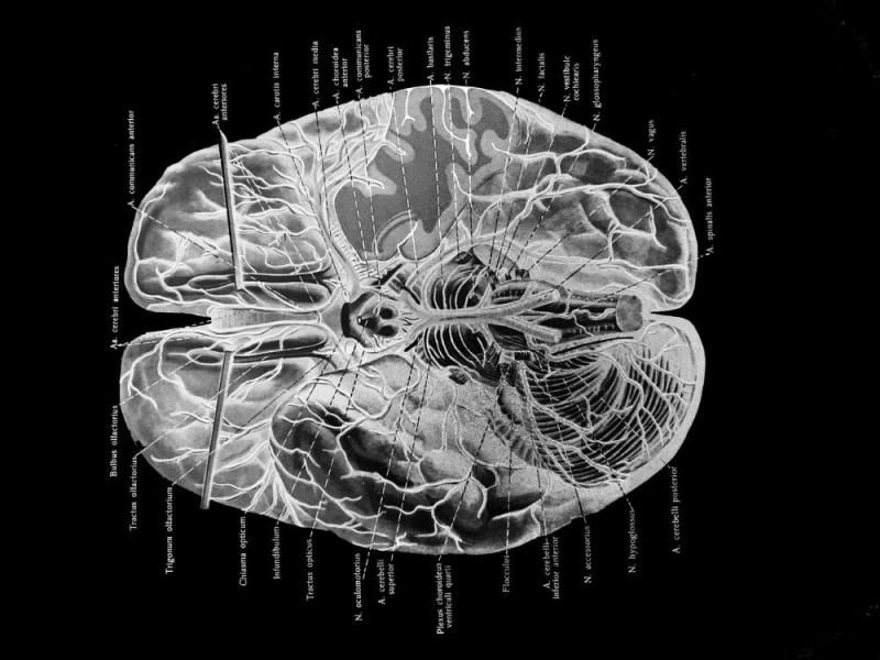 Sección del cerebro. 